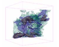 3-D Medical Imaging Reaches The Stars
