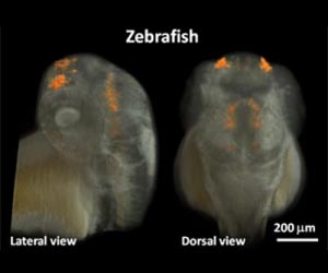 Sharper deeper faster 3D imaging