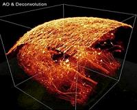 New technique takes cues from astronomy and ophthalmology to sharpen microscope images