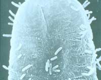 Structure Mediating Spread Of Antibiotic Resistance Identified