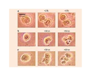 Steering Cancer Inflammation To Inhibit Tumor Growth And Spread