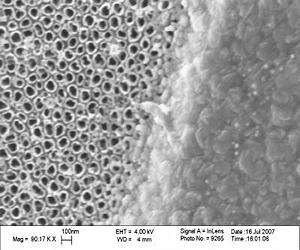 Nanomodified Surfaces Seal Leg Implants Against Infection