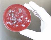 Compound May Aid Detection Of Chemical And Biological Weapons