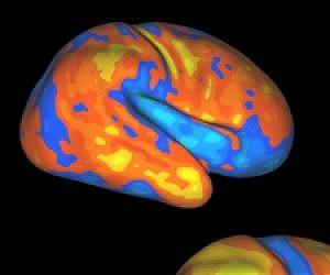 Baby Brain Growth Mirrors Changes From Apes To Humans