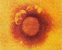 New arenavirus found in S. Africa, Zambia