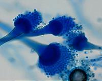 What happens to a pathogenic fungus grown in space?
