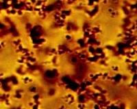 Asphaltene analysis takes a giant step