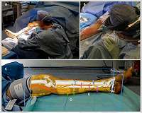 VR helps surgeons to 'see through' tissue and reconnect blood vessels