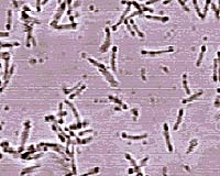Scientists Rebuild Ancient Proteins To Reveal Primordial Earth's Temperature