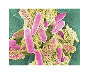 BGI Sequences Genome of the Deadly E. Coli in Germany and Reveals New Super-Toxic Strain