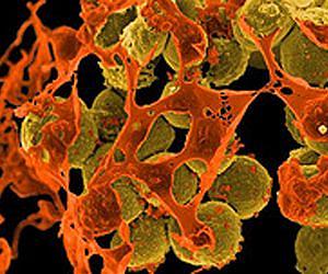 Superbug MRSA Identified in U.S. Wastewater Treatment Plants