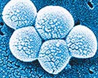 Bacteria epidemic at Madrid hospital claimed 18 lives: report