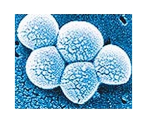 Evolution of staph 'superbug' traced between humans and food animals