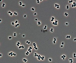 Researchers find a missing component in effort to create primitive, synthetic cells