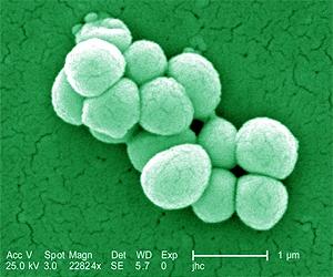 Enzyme Trio For Biosynthesis Of Hydrocarbon Fuels