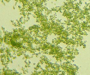 DNA code sheds light on world-ranging algae