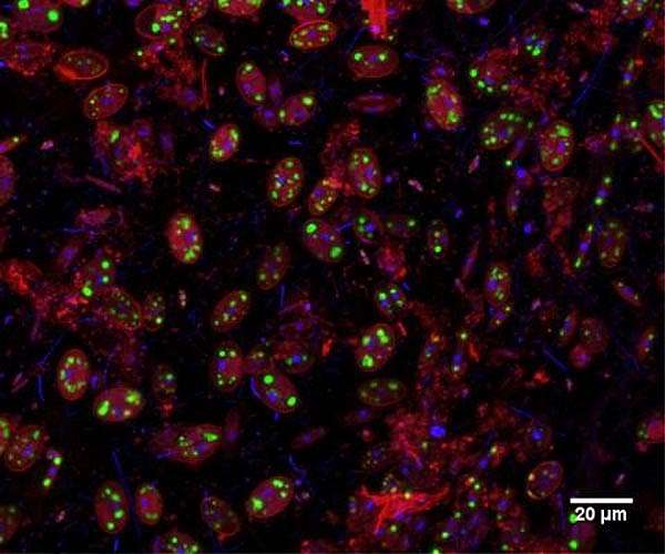 Bacteria can stick to plastic in the deep sea to travel around the ocean