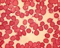 Town in China sealed off after pneumonic plague kills two