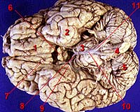 Mapping The Selective Brain