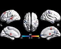 Autistic and non-autistic brain differences isolated for first time