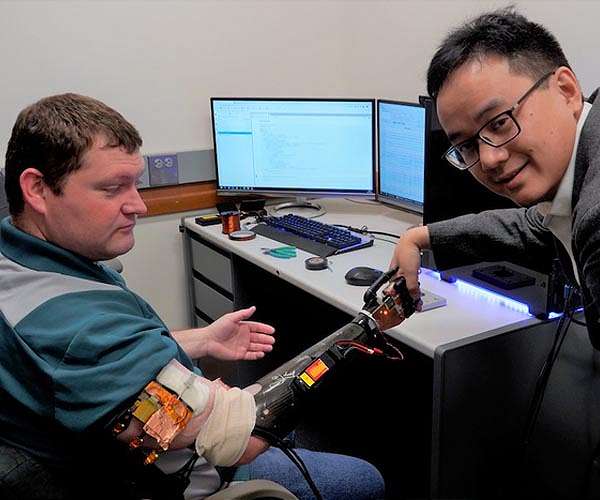 University of Minnesota technology allows amputees to control a robotic arm with their mind