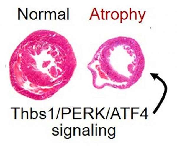 Cardiac atrophy findings may set course for preventing harm from long space flights