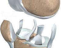 Easy recipe to make bone and cartilage