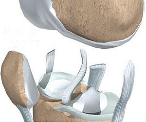 Cartilage made easy with novel hybrid printer