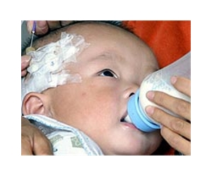 Natural birth a tough sell in China's caesarean boom