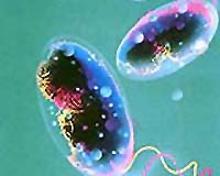 Guinea-Bissau's cholera epidemic claims more lives