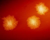Superbugs could kill a million Chinese a year: economist