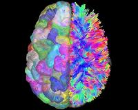 How the brain's wiring leads to cognitive control