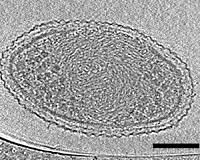 Ultra-small bacteria detailed in new microscope imagery