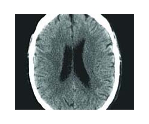 Brain scans don't lie about age
