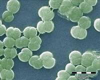 Iron-silica particles unlock part of the mystery of Earth's oxygenation