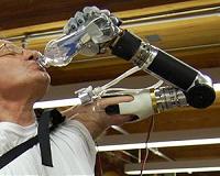 Mind-controlled prosthetic arms that work in daily life are now a reality