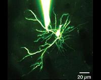 US military awards $40 million toward memory implant