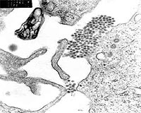 First Climate-Based Model That Predicts Dengue Fever Outbreaks
