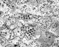 Dengue deaths on rise in Sao Paulo
