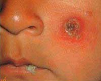 McMaster Researchers Discover New Mode Of How Diseases Evolve