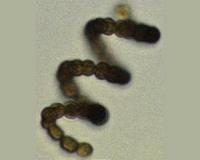 Scientists help public avoid health risks of toxic blue-green algae