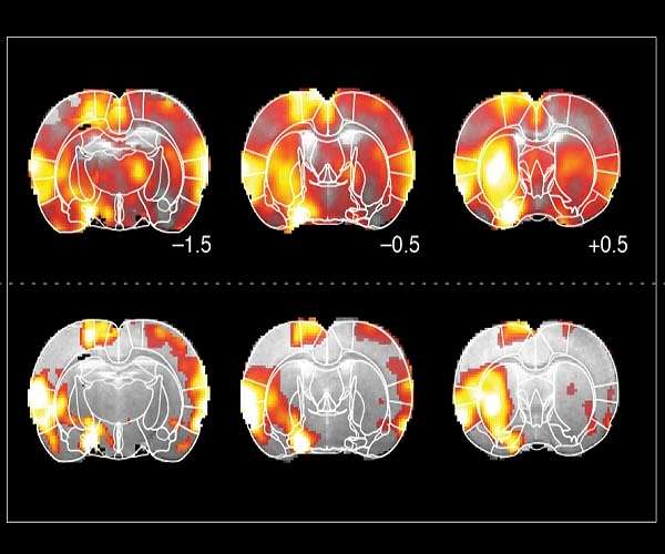Converting brain activity to text on one extremely small integrated system