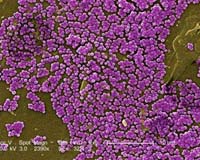 Epidemic superbug strains evolved from one bacterium: study
