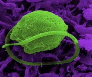 Algae held captive and genes stolen in crime of evolution