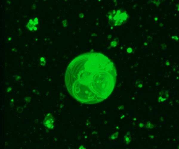 How life's building blocks formed on early Earth examined through polyester protocell formation limits