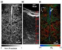 High-tech method allows rapid imaging of functions in living brain