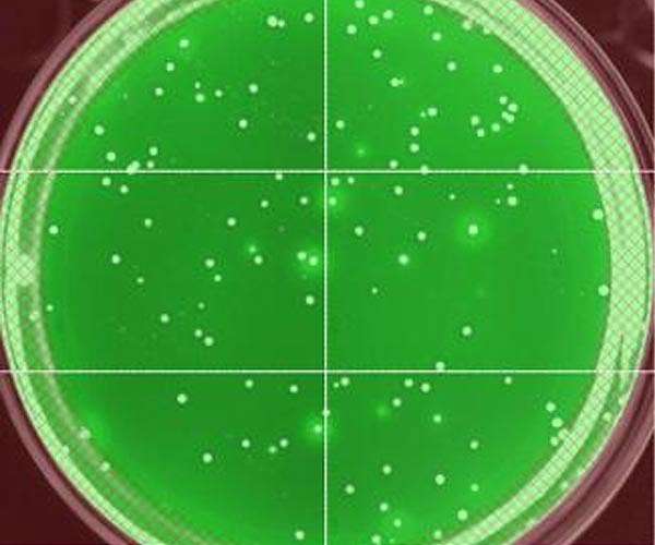 HIV-positive 'elite controllers' offer clues for cure