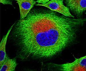 Can you predict how a disease will spread in a population?