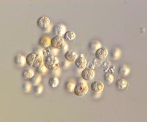 Malaria deaths in India 'underestimated'