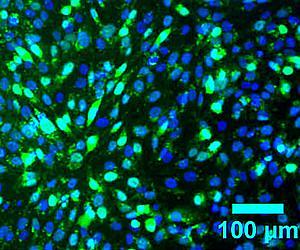 Beacons light up stem cell transformation